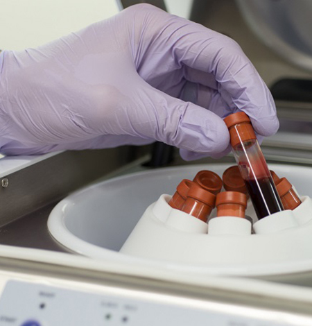 Platelet Rich Plasma Centrifuge PRP blood tube