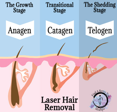 3 Stages of Laser Hair Removal