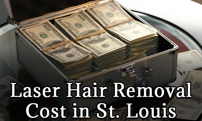 Laser Hair Removal Prices in St Peters