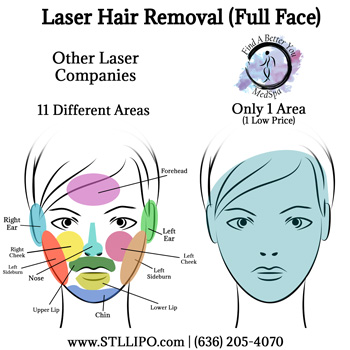 Full Face Differences between Find A Better You Med Spa and other Laser Companies