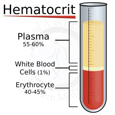 Elevated Hematocrit Levels in a Blood Test